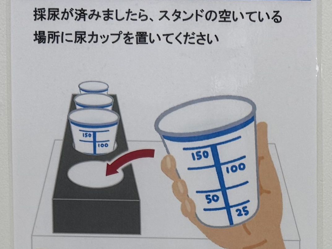 採尿について
