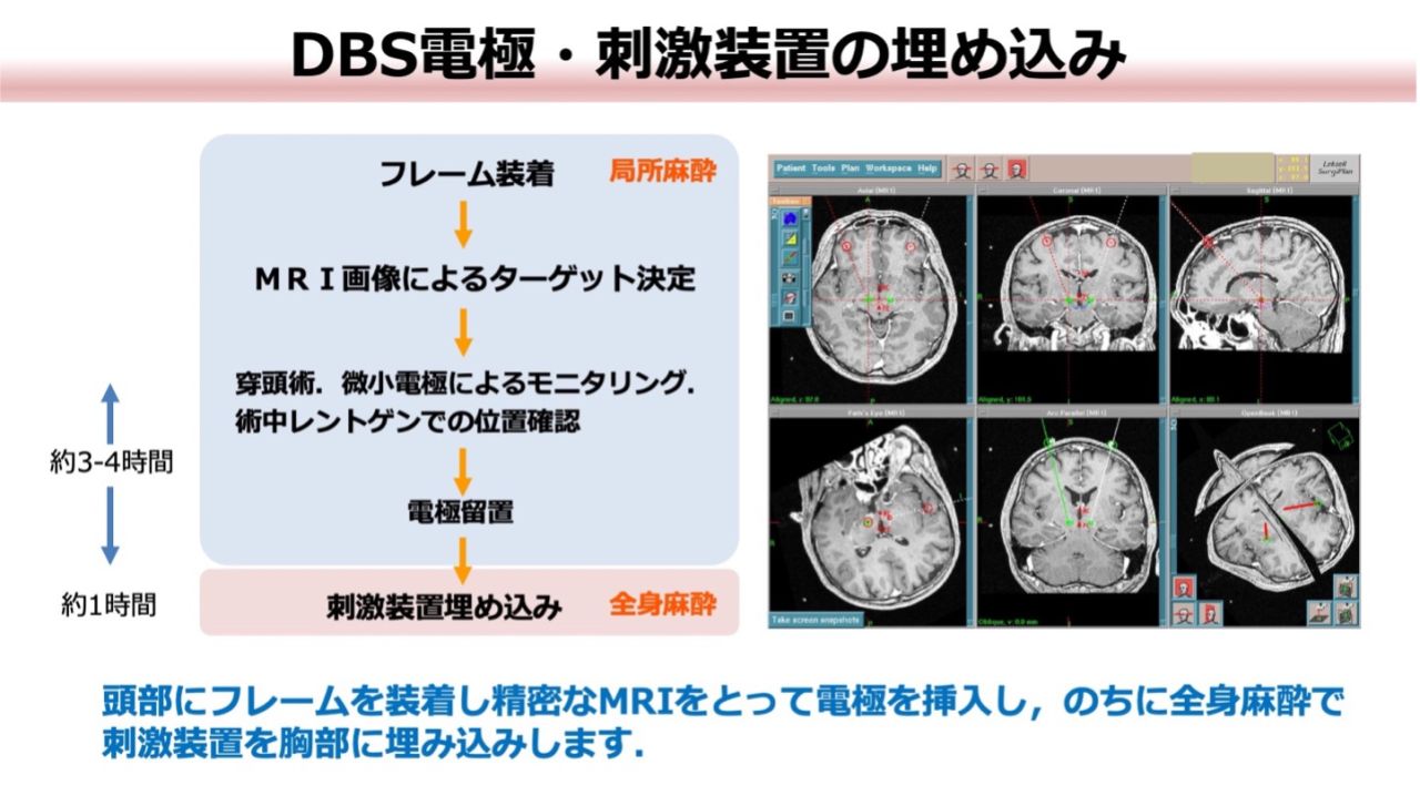 6_手術.jpg