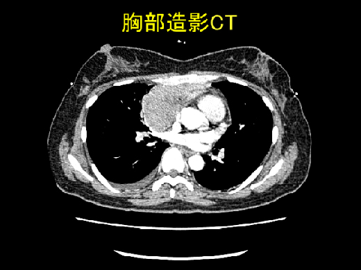 study_slide02_14.jpg