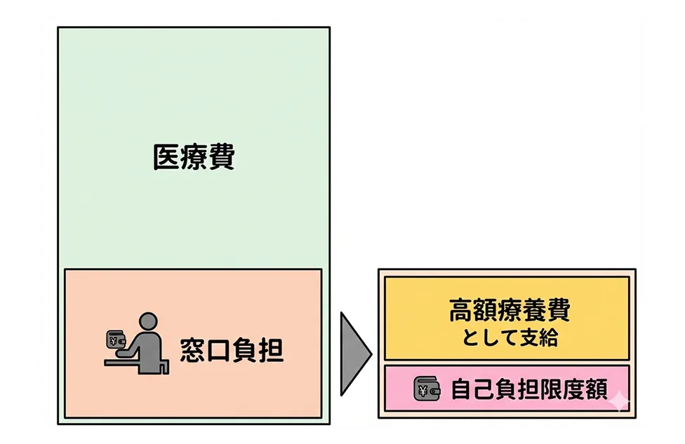高額療養費制度のイメージ図