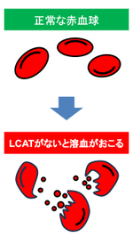 溶血状態４.png