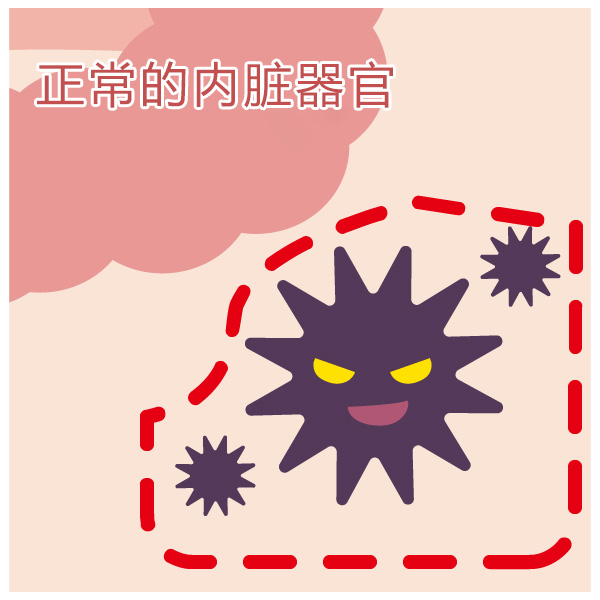 自适应放射线治疗(MR直线加速器)