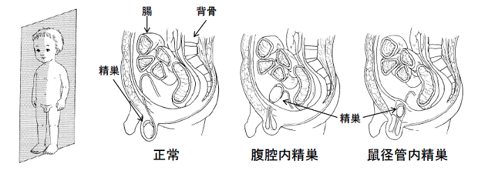 病態に関する説明用紙