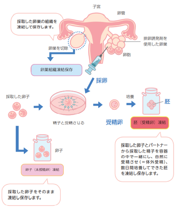 がん治療を開始するにあたって女性用「小児・若年がん長期生存者に対する妊孕性のエビデンスと生殖医療ネットワーク構築に関する研究」班（編）より引用